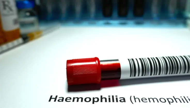 Genetinės ligos diagnozė nepakeičia svajonių: gyvenimas su hemofilija šiandien