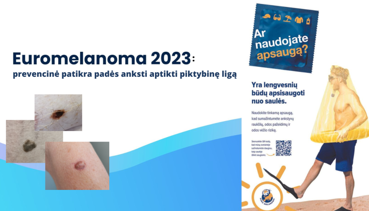  Euromelanomos diena: prevencinė patikra padeda anksti aptikti piktybinę ligą 