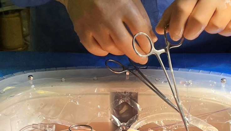Santaros klinikos: po nėštumo sukeltų komplikacijų gyvybę išgelbėjo donoro kepenys