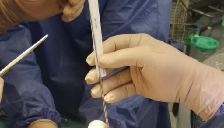 Santaros klinikose atlikta reto kaulų defekto operacija panaudojant „augantį“ implantą