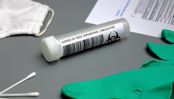 Naujas tyrimo metodas leis daugiau ir greičiau atlikti profilaktinių SARS-CoV2 testų bei saugiau sušvelninti karantino sąlygas