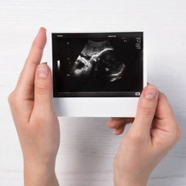 depositphotos_255365776-stock-photo-woman-holding-ultrasound-photo-of-1c66af8c84d91a1f5c248cd23646651e.jpg